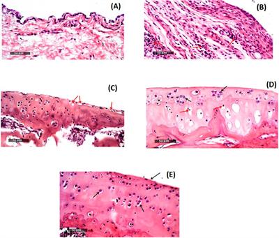 Diacerein-loaded surface modified iron oxide microparticles (SMIOMPs): an emerging magnetic system for management of osteoarthritis via intra-articular injection